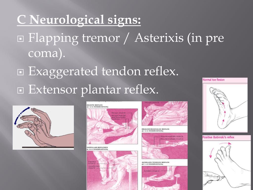 Hepatic encephalopathy ppt download